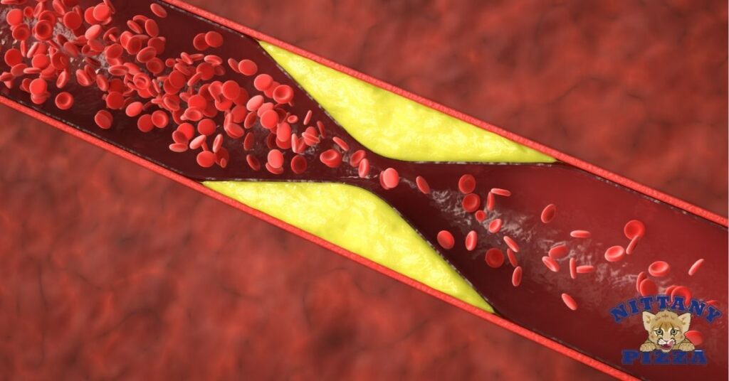 Understanding Cholesterol And Its Impact On Health